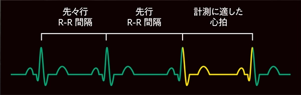 R-R Navigationの説明図