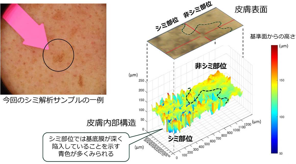 LC-OCTと独自のAI画像解析により可視化したシミ内部の基底膜構造を表した図