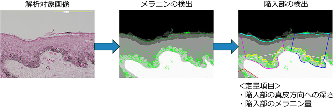 皮膚断面画像のAI画像解析フローを表した画像