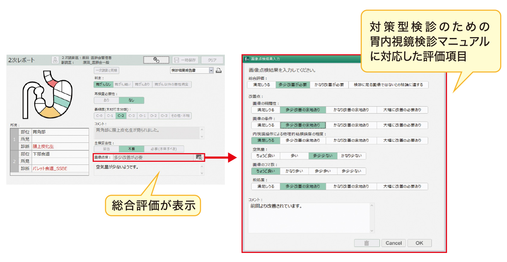 画像点検画面。対策型検診のための胃内視鏡検診マニュアルに対応した画像評価を実施。​​