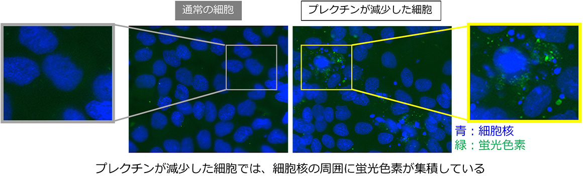 基底膜浸透型リポソームによるプレクチンが減少した細胞への取り込みを表した画像