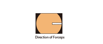 Image area and dirrection of forceps