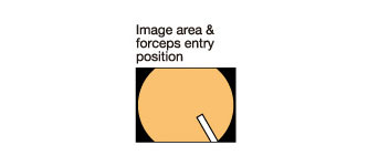 [image] Image area & forceps entry position