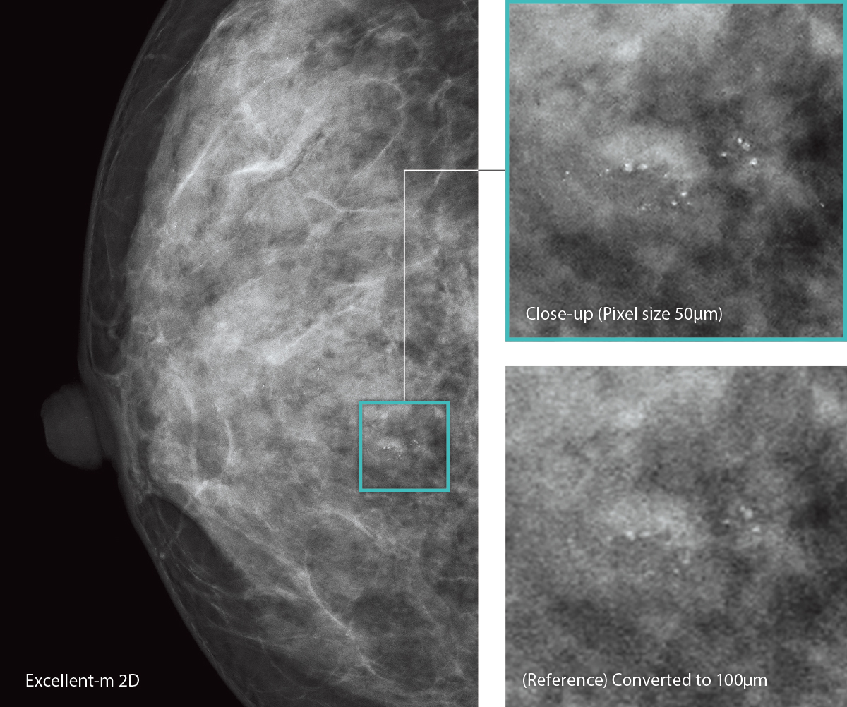 3 imágenes de mamografía (Excellent m2D, tamaño del panel 50 μm, 100 μm)