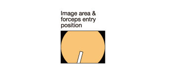 [image] Posición de entrada de las pinzas y área de la imagen