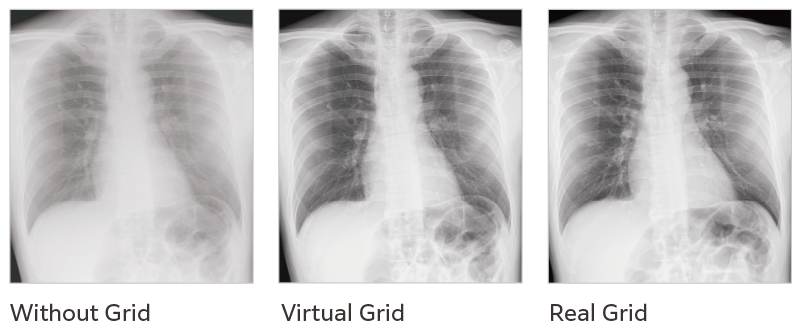 Virtual Grid​