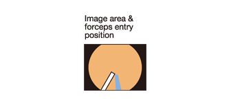 Área de imagen, & posición de entrada de las pinzas