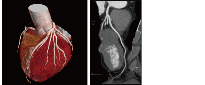Reconstructed cardiac phase