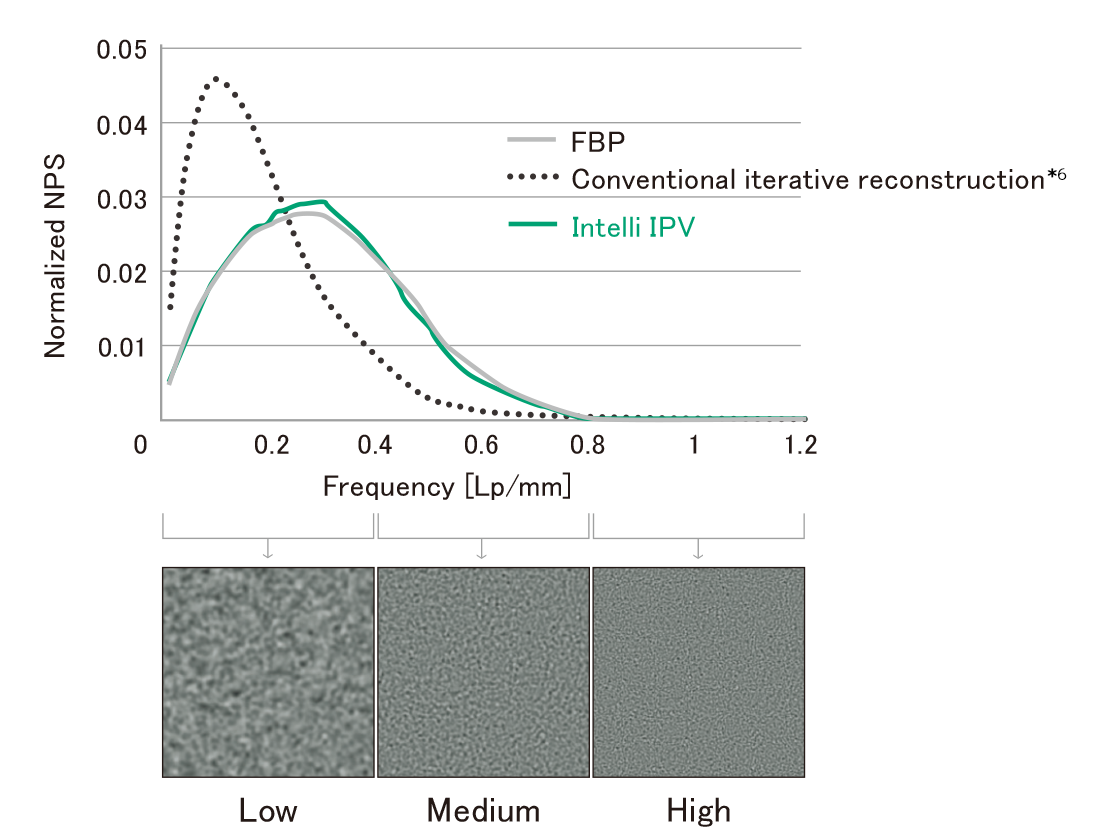 There is a graph of normalized NPS for FBP image, conventional iterative reconstruction image and Intelli IPV image in each frequency band here.
