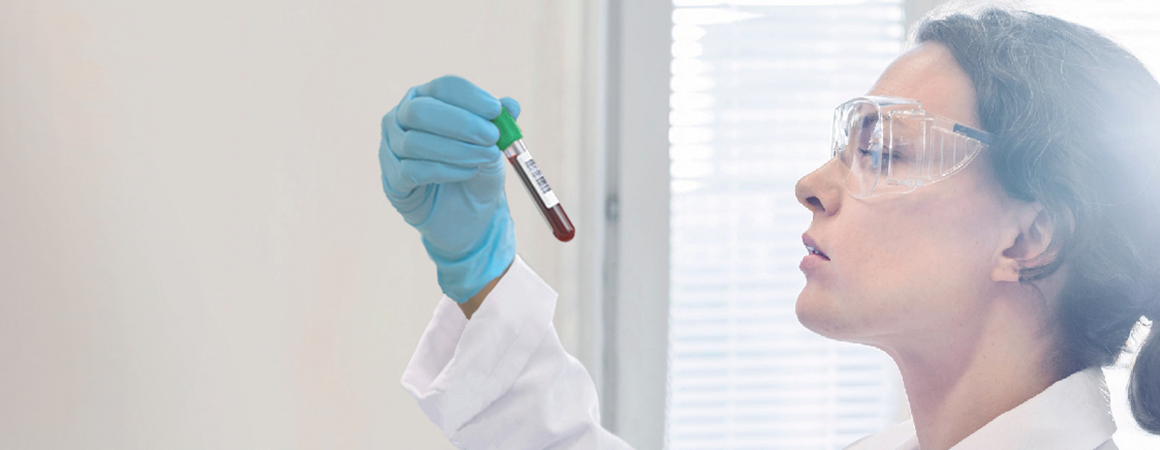 Healthcare professional wearing lab coat and blue gloves holding vial of blood up and looking at label