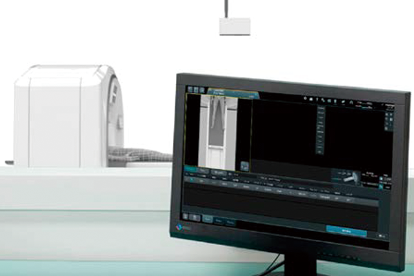 A figure showing the AutoPositioning video is displayed on the Operation Console.