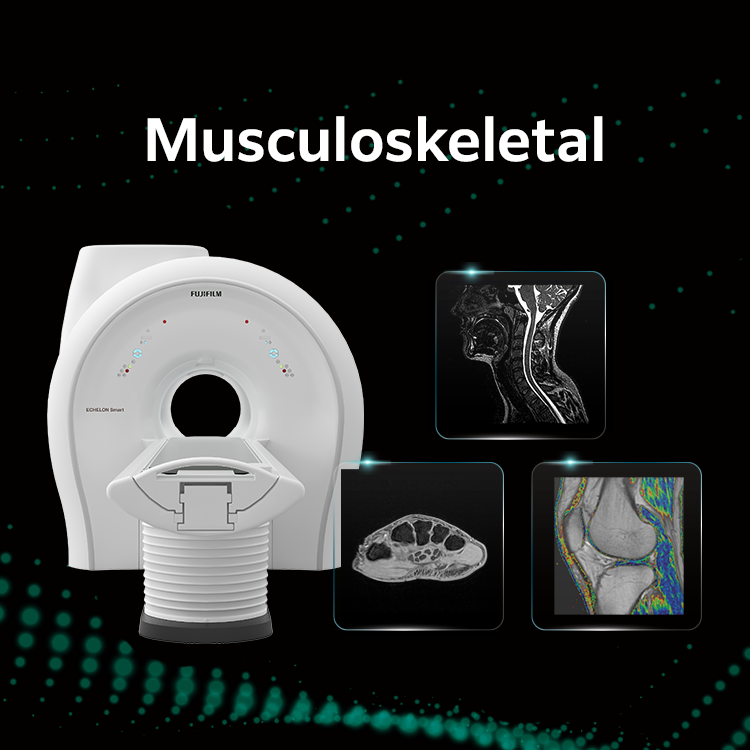 裁断済 Diagnostic Imaging: Musculoskeletal Musculoskeletal | Fujifilm [Malaysia]