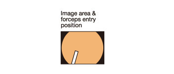 Image area & forceps entry position