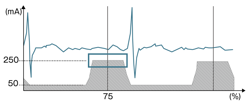 IntelliEC Cardiac
