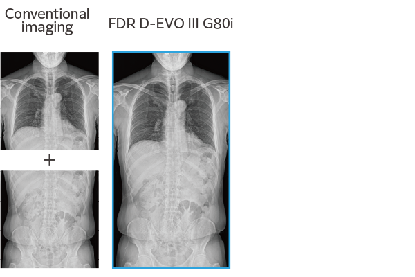 Comparison between conventional imaging and FDR D-EVO III G80i