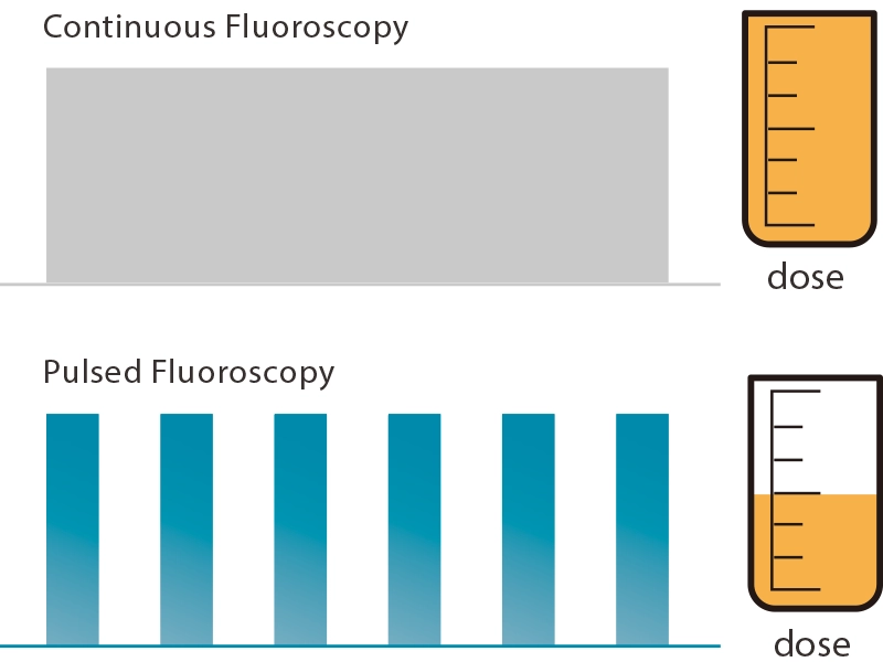 Comparison between continuous fluoroscopy and pulsed fluoroscopy