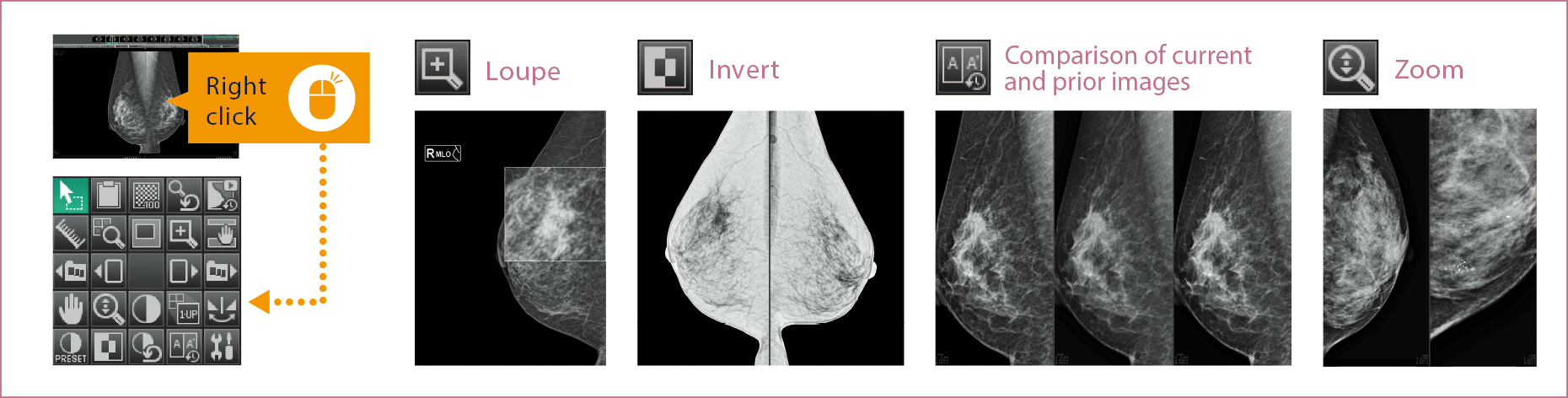 [image] Lupa, Invertir, Comparación de imágenes actuales y anteriores y zoom de radiografías
