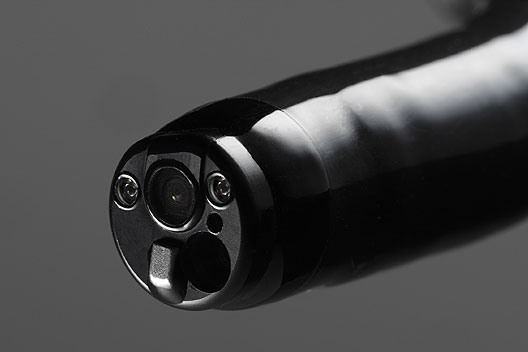 [photo] Distal end/tip of gastroscope, with functional parts