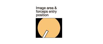 [image] Image area & forceps entry position