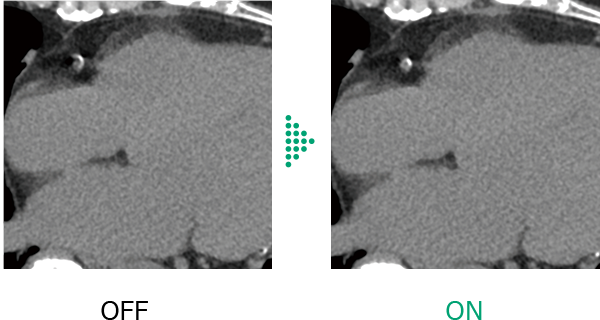 Here are comparative images of axial cross sections in the cardiac region, showing differences between cases without and with Cardio StillShot, which suppresses motion blur. By applying corrections during image reconstruction, Cardio StillShot achieves an effective temporal resolution of up to 28 milliseconds in cases with 0.5 seconds per rotation and heart rates of 80 bpm or less. It is a dedicated option for the Operator Console CT-OC-23D and cannot be installed in CT-OC-23C.