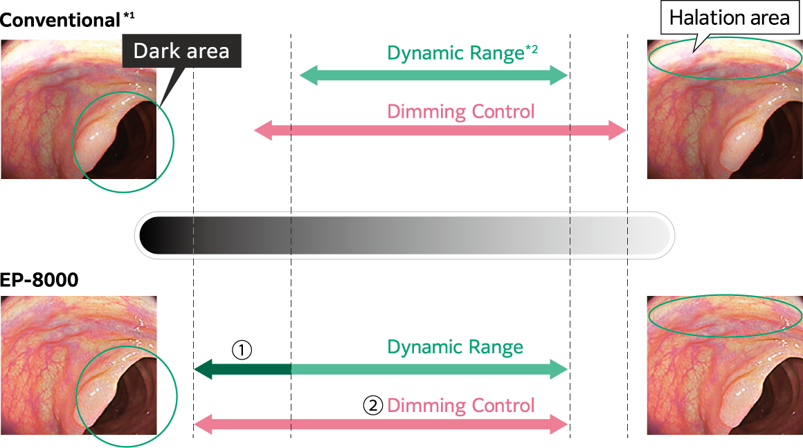 The effect of Extended Dynamic Range and comparison between Eluxeo 7000 and Eluxeo 8000 system 