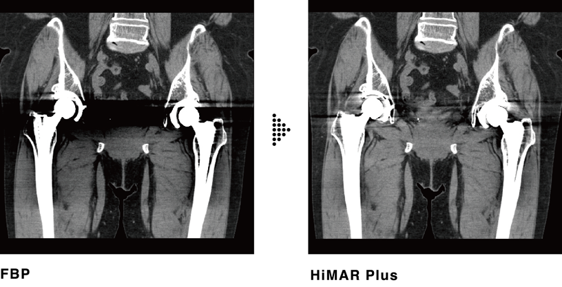Clinical images [HiMAR Plus]