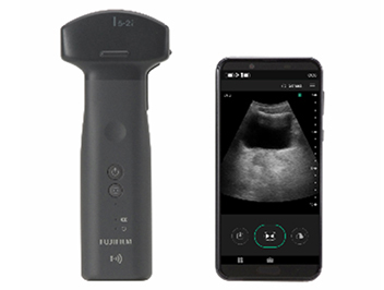 ultrasound diagnostic imaging device “iViz air Convex”