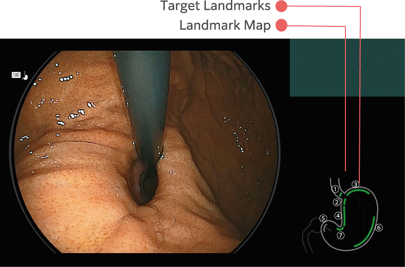 Landmark Photo Checker working with White Light mode in the stomach.