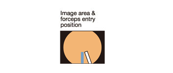 Image area & forceps entry position