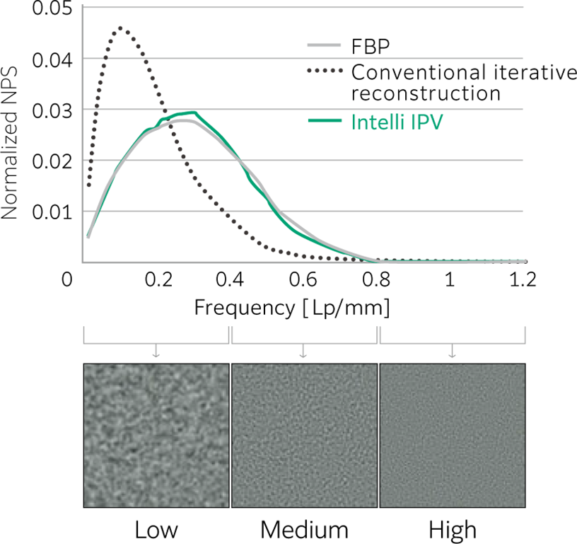 There is a graph of normalized NPS for FBP image, conventional iterative reconstruction image and Intelli IPV image in each frequency band here.