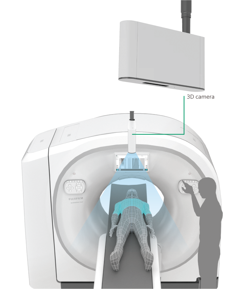 There is an illustration adjusting a patient position with the 3D camera mounted in the ceiling which recognizes the feature points of the patient lying on the patient table here.