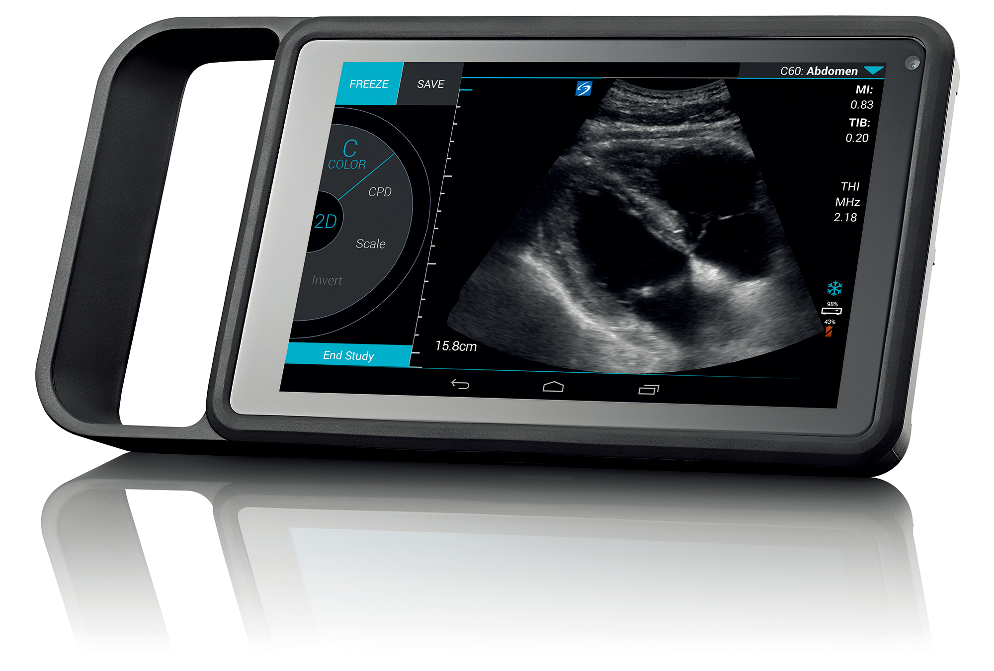 SonoSite iViz : Product Images | Fujifilm [Thailand]