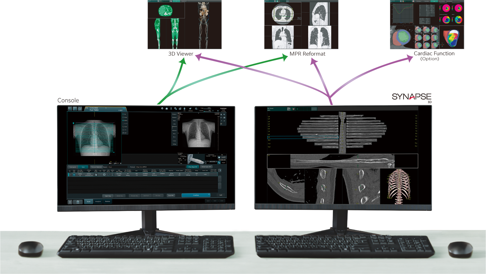 This figure shows the transition from the displayed CT imaging settings on the SCENARIA View’s console monitor to the same 3D Viewer screen and Multi Planar Reconstruction (MPR) reformat screen as SYNAPSE 3D. It also shows the transition from the analysis screen on SYNAPSE 3D’s monitor to the screen of a 3D Viewer, a MPR reformat and the screen of Cardiac Function (Cardiac Function is option). 