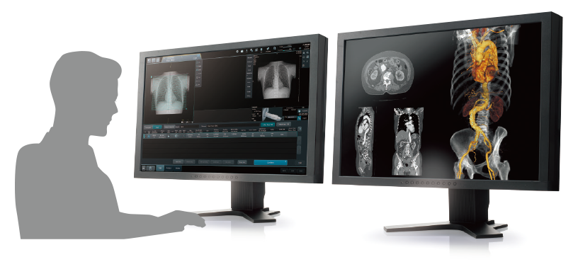 A figure showing the operator with the SCENARIA View console and SYNAPSE 3D placed side by side. Fujifilm Group's image processing technology supports efficient operations through a common platform.