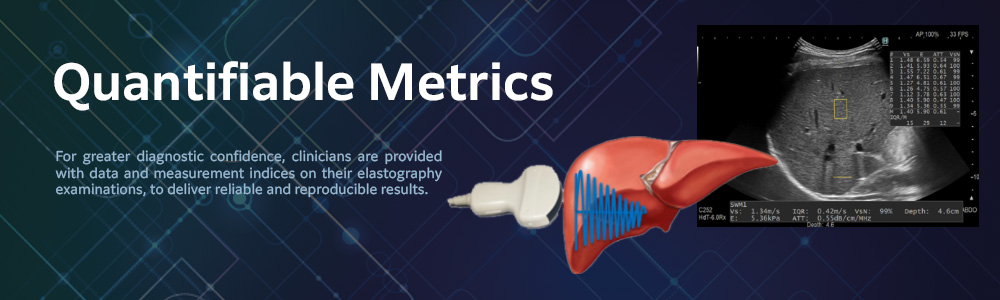 Quantifiable Metrices