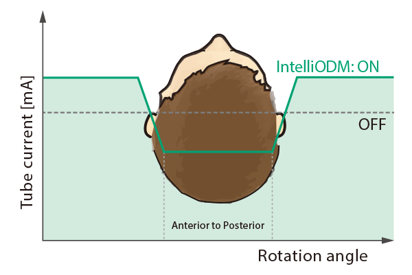 Here is a graph showing rotation angle on the horizontal axis and tube current on the vertical axis, comparing tube current with and without the IntelliODM function.