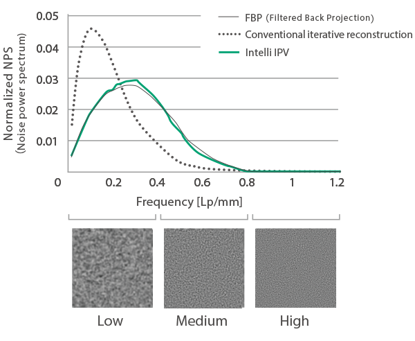 Here is a graph showing the normalized noise power spectrum from low to high frequencies. It displays the waveforms for FBP, conventional iterative reconstruction, and Intelli IPV. The Intelli IPV waveform is nearly identical to the conventional FBP waveform.