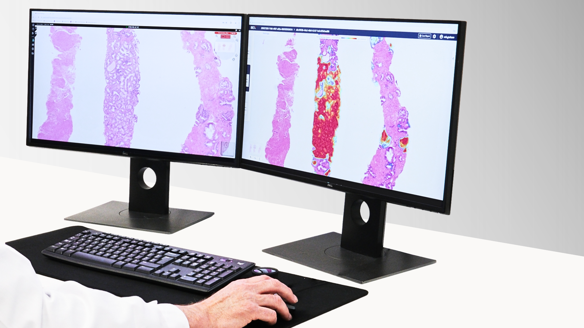 Two monitors with a keybord in front of them