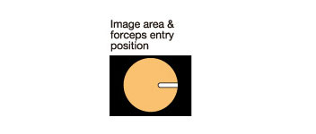 [image] Image area & forceps entry position