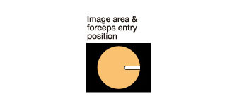 [image] Image area & forceps entry position