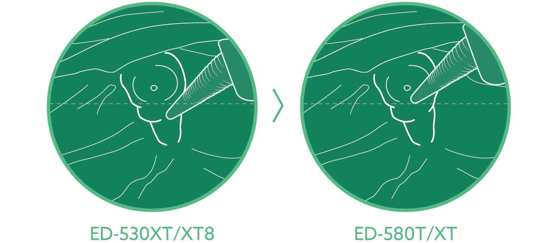 [image] ED-530XT/XT8 and ED-580T/XT angles of forceps elevator in stomach