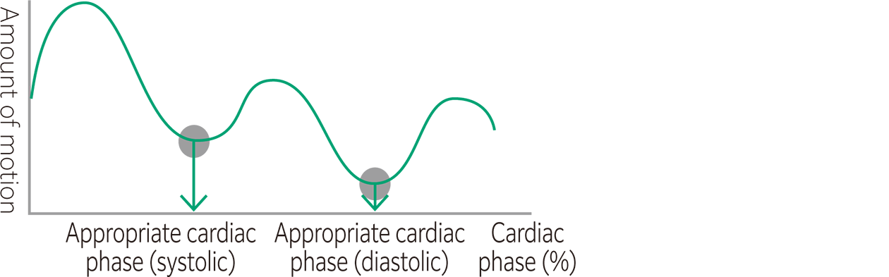 There is a graph of showing the amount of cardiac movement in each diastolic cycle here.
