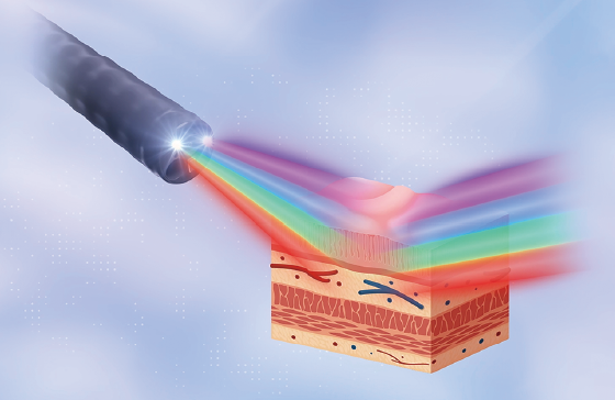 Image of Multi Light Technology​