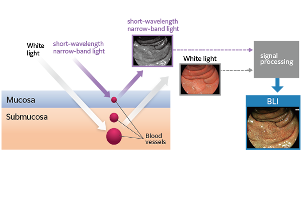 The principle of BLI​
