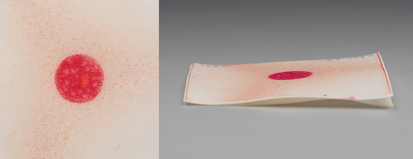 Heat-induced discoloration and base deformation when used standard Prescale