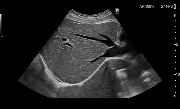 This ultrasound image represents “New Diagnostic Possibilities Woven by High-Performance Architecture.”