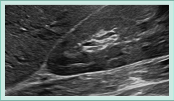 Image with the “Carving Imaging” applied.