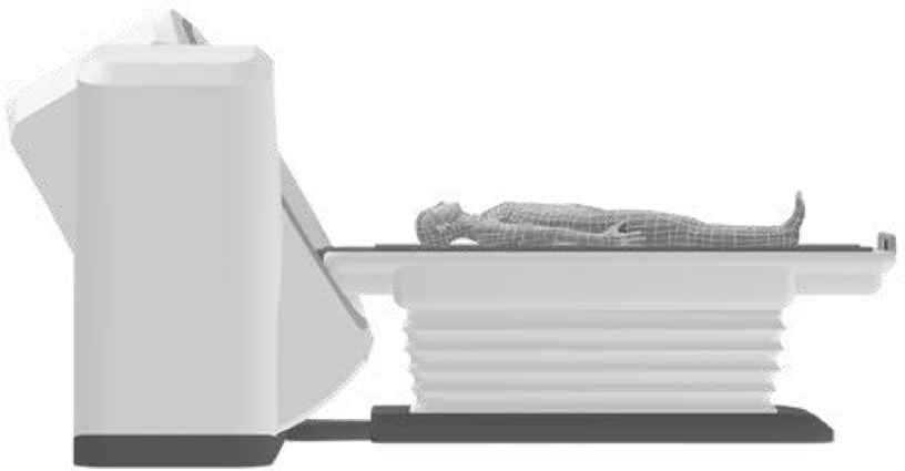 There is an illustration showing how the gantry tilts from the normal position state with a patient lying on a patient table here.