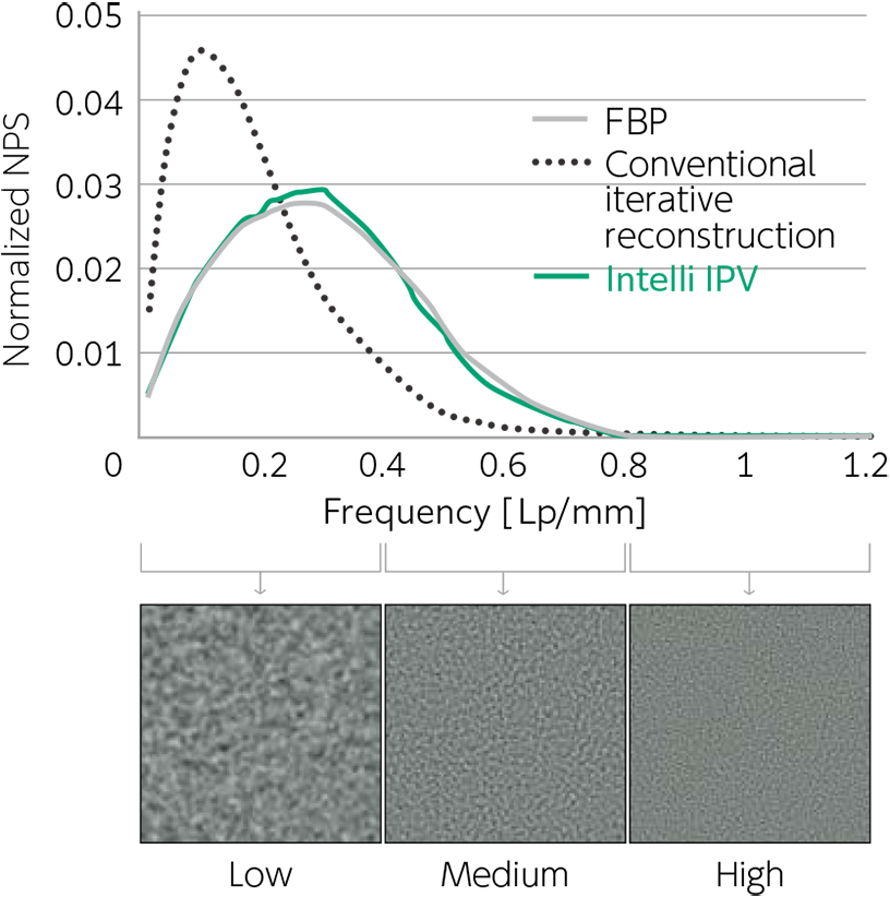 There is a graph of normalized NPS for FBP image, conventional iterative reconstruction image and Intelli IPV image in each frequency band here.