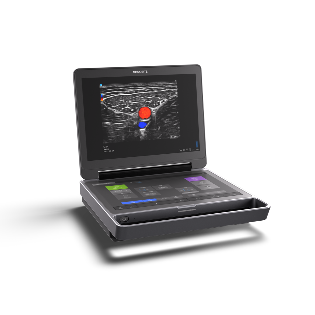 Sonosite MT Ultrasound System